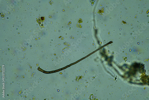 soil fungi storing carbon in the soil. testate amoebae and bacteria cycling nutrients. regenerative agriculture sustainable practices growing healthy food on farms and in crops photo