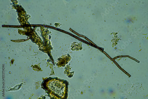 soil fungi storing carbon in the soil. testate amoebae and bacteria cycling nutrients. regenerative agriculture sustainable practices growing healthy food on farms and in crops photo