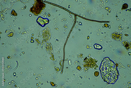 soil fungi storing carbon in the soil. testate amoebae and bacteria cycling nutrients. regenerative agriculture sustainable practices growing healthy food on farms and in crops photo