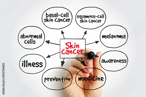 Skin cancer mind map, medical concept for presentations and reports photo