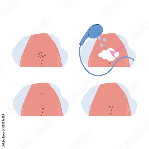 4 steps of shaving routine. Real female body with stretch marks. Set of woman shaves her pubic hair with razor. Flat vector illustration in flat style.