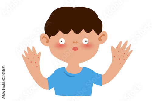 hand foot and mouth Disease symptoms. vector illustration