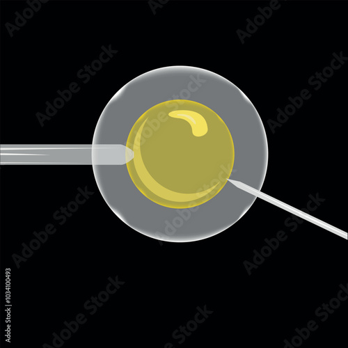 Artificial insemination. Female fertility.