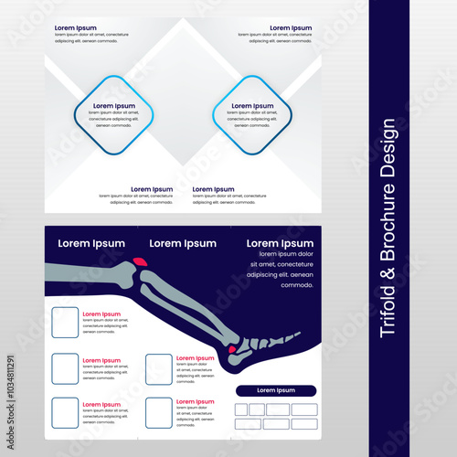  Medical Trifold Brochure Template with Leg Anatomy | Design Layout for Orthopedic Hospital