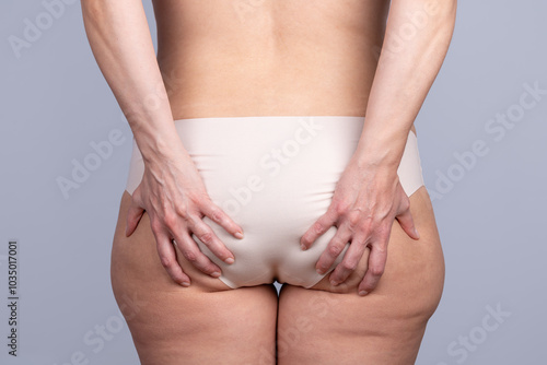 Wallpaper Mural Close-up rear view of the buttocks of a slightly overweight woman with cellulite and her hands grasping the fat of the buttocks. Concept of woman, cellulite, overweight and diet Torontodigital.ca