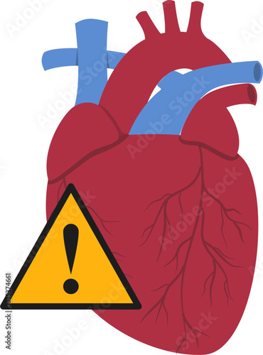 Heart disease illustration. Cardiovascular disease illustration.