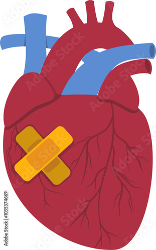 Heart disease illustration. Cardiovascular disease illustration.