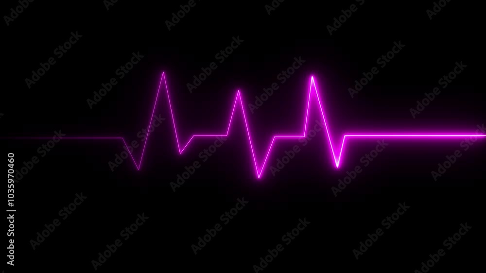 Heart Rate Monitor Electrocardiogram Ekg Or Ecg Looping background Heart Rate Monitor Electrocardiogram Ekg Or Ecg Looping background