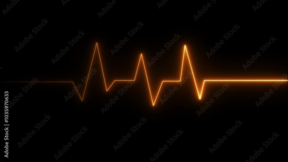 Heart Rate Monitor Electrocardiogram Ekg Or Ecg Looping background Heart Rate Monitor Electrocardiogram Ekg Or Ecg Looping background