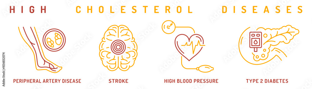 High cholesterol diseases infographic with linear pictograms. High cholesterol diseases infographic with linear pictograms.