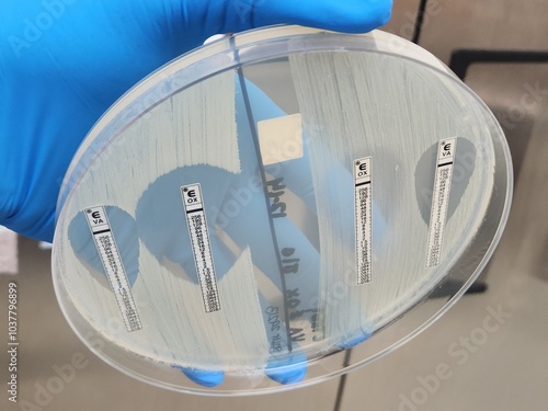 Methicillin sensitive and resistant staphylococcal isolates - E-test photo