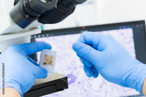 Scientist wear blue glove holding parafin human tissue block and slide with out of focus microscope and computer monitor show glandular image.Medical patholology and cytology laboratory technology photo