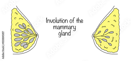 Involution of the mammary gland