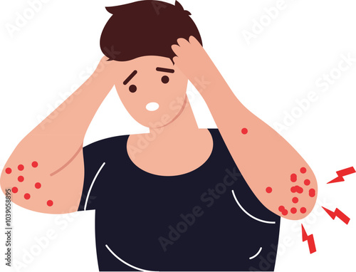 Autoimmune, dermatitis,urticaria,Bullous pemphigoid,herpetiformis,Dermatomyositis,Epidermolysis bullosa acquisita,Gestational,Hidradenitis suppurativa,Lichen planus,Linear IgA,Psoriasis