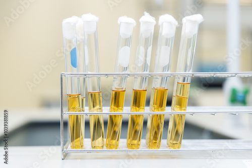 MPN coliform E.Coli testing: The most probable number (MPN) technique is a method for estimating the number of bacteria in a food or water sample in laboratory. photo