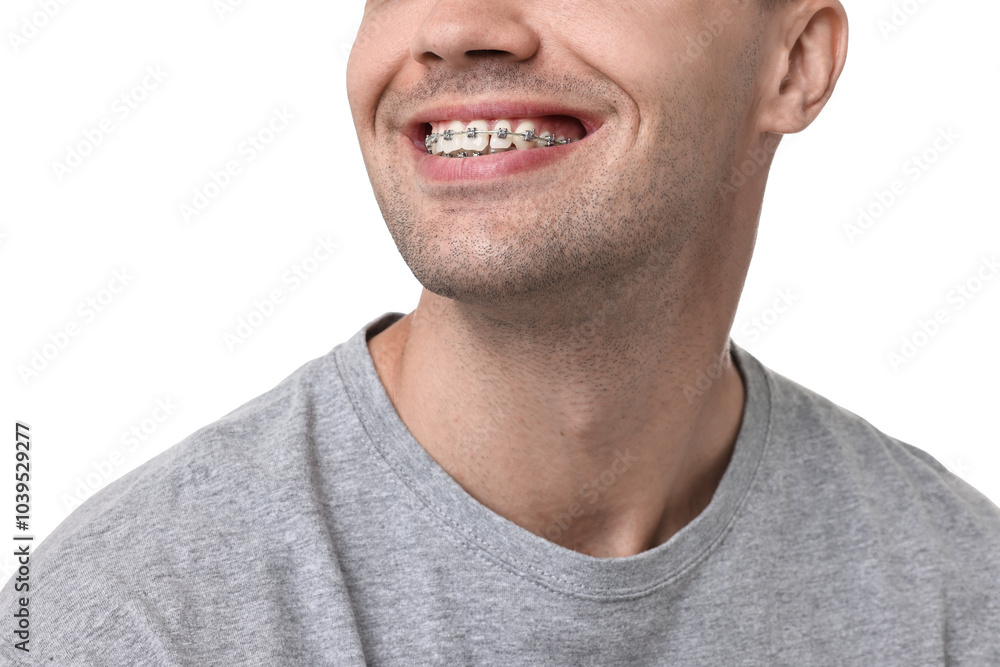 Smiling man with dental braces on white background, closeup Smiling man with dental braces on white background, closeup