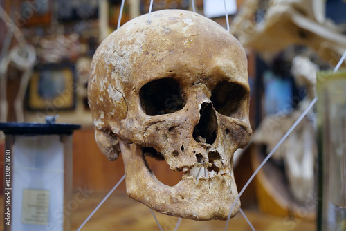 Obraz na plátně Bones of human skull for studying. Human skull
