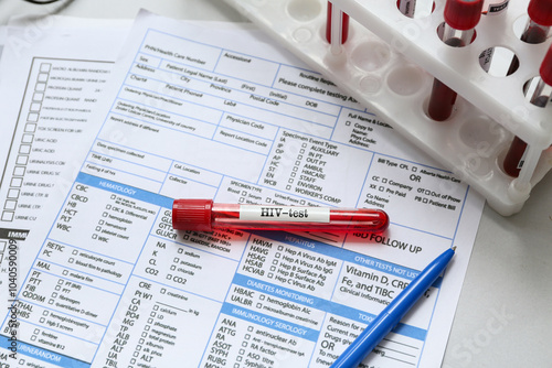 HIV blood test tubes and la...