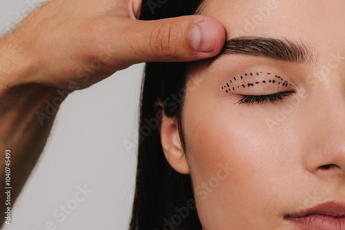 Foto Blepharoplasty mark up