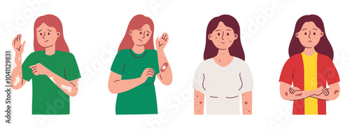 Woman with Unhealthy Skin, Woman with Wound, Vitiligo, Smallpox