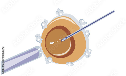 Artificial insemination of oocyte, intracytoplasmic injection, IVF. Introduction of sperm into egg with a needle - vector, color illustration