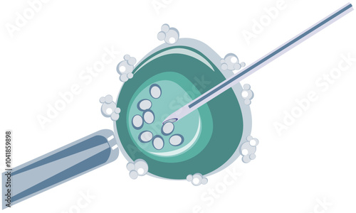 Transvaginal puncture of follicles with a needle, collection of eggs, stage of in vitro fertilization, IVF - vector, color illustration