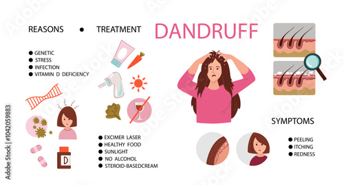 Young woman with dandruff problem. Symptoms, infographic, treatment.Health medicine, trichology, dermatology concept. Vector hand drawn flat cartoon illustration.