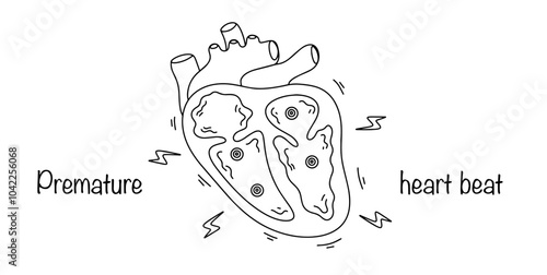 Premature heart beat