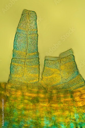 Papillose peristome teeth of an Orthotrichum moss at 400x. photo