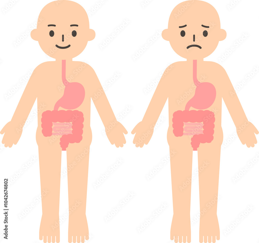 人物と胃腸のデフォルメイラスト