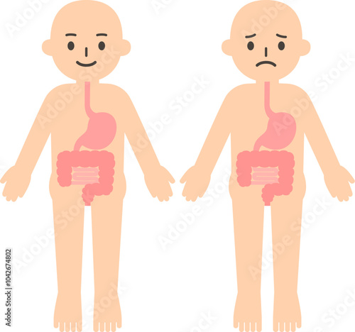 人物と胃腸のデフォルメイラスト