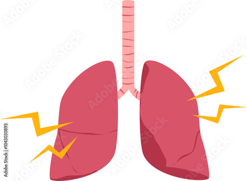 Lung disease. Respiratory disease illustration.