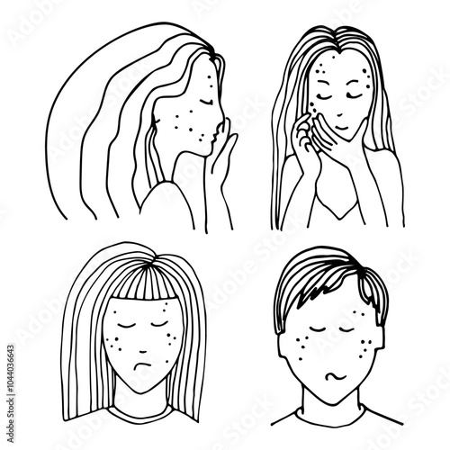 Sad girls and boy with acne on the face. Pimple on the face. Dermatology problem and puberty. Trouble with skin. Hand drawn line vector illustration