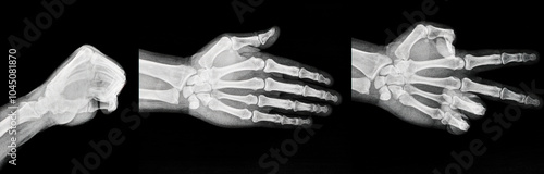 Film xray x-ray or radiograph of Rock paper scissors, a hand game, usually played between two people in which each player simultaneously forms one of three shapes with an outstretched hand