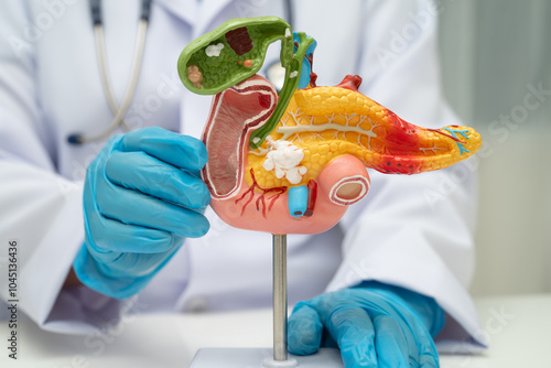 Pancreatitis, pancreatic cancer, Asian doctor with pancreas, gallbladder and bile duct human anatomy model at hospital. photo