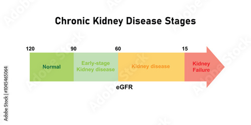 Chronic Kidney Disease (CKD) Stages Scientific Design. Vector Illustration.
