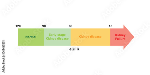 Chronic Kidney Disease (CKD) Stages Scientific Design. Vector Illustration.
