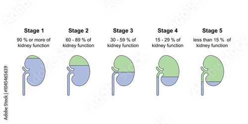 Chronic Kidney Disease (CKD) Stages Scientific Design. Vector Illustration.
