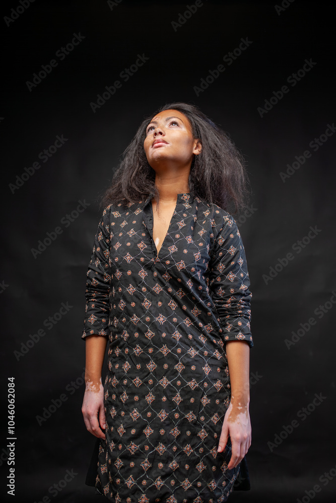 Pensive woman in traditional black kurta standing against black background. Young thoughtful woman with vitiligo skin disorder is looking up in studio. Pensive woman in traditional black kurta standing against black background. Young thoughtful woman with vitiligo skin disorder is looking up in studio.