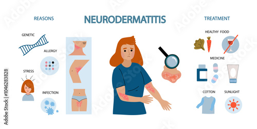 caucasian woman suffers from atopic dermatitis. Neurodermatitis symptoms and reasons infographic. Human skin infection dermatitis diagnosis. Vector doodle hand drawn flat illustration	