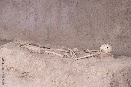 Human skeleton at archaeological site with surgery trepanned skull hole. Human skull with trepanation. photo