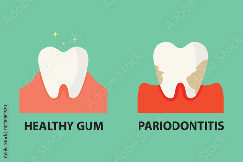 Stomatological concept. Comparison between healthy tooth and periodontitis tooth. Vector illustration.
