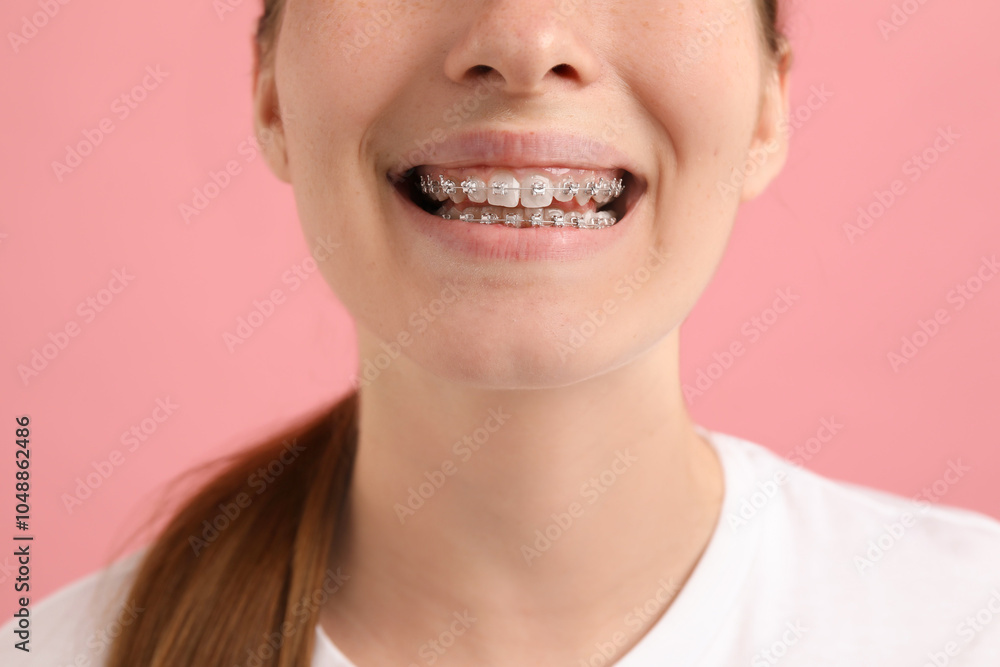 Girl with braces on pink background, closeup Girl with braces on pink background, closeup
