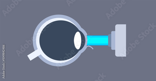 Lasik eye surgery