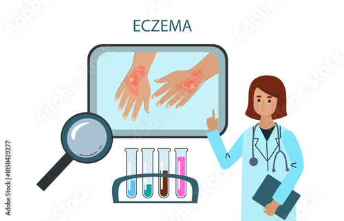 woman suffers from eczema. Psoriasis, dermatitis, Atopic dermatitis, Neuro dermatitis  and eczema skin diseases test. Symptoms and reasons infographic.Vector doodle hand drawn flat illustration