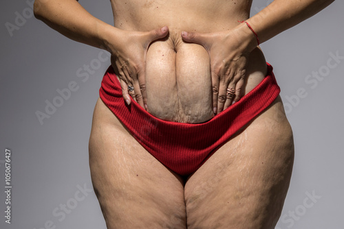 Overweight woman showing cellulite legs and belly fat, obesity female body, Gray background. Front view.