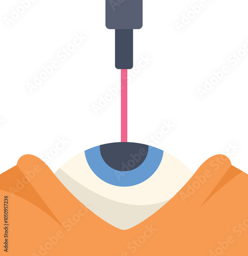 Laser surgery correcting vision problems by operating on the cornea to improve vision acuity