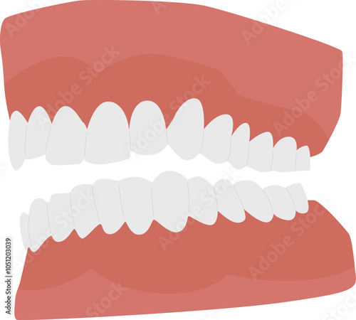 dentures