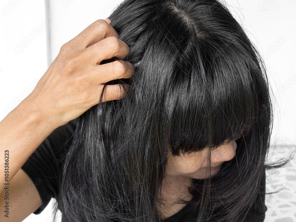 Dandruff Itchy scalp, woman chtatch hair messy she dirty, sensitive disease bacteria dander loss, concept for medicine hyginene champoo treatment skin for good health. Dandruff Itchy scalp, woman chtatch hair messy she dirty, sensitive disease bacteria dander loss, concept for medicine hyginene champoo treatment skin for good health.