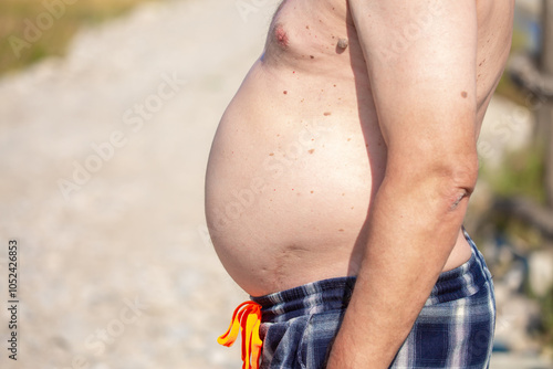 Big belly in a man. Close-up front view of a male body, shirtless, big belly, bloating, arms pressed to the body, belly button. Obesity, poor nutrition. photo